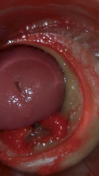 Camera Inside Deep Pussy Captures Huge Ejaculation of Sperm Asmr