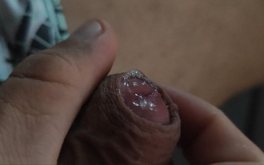 Boy with a Red Dick About to Explode