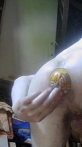 Anal Training & Rectal Prolapse