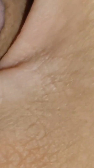 Amazing Dilator Vessel Has Disproportionate Increase.