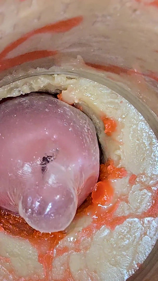 The Camera 4K Inside the Deep Pussy Records a Huge Ejaculation with a Stuck Condom