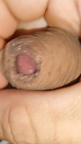 Cumshot of the Largest Phimosis Foreskin in the World.