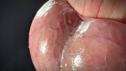 Massage the Eggs and Then Come