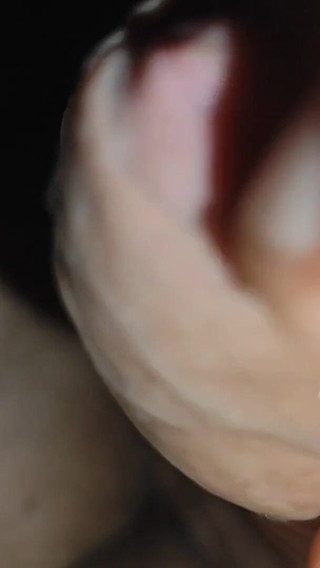 Young Man with Phimosis Opening the Glans