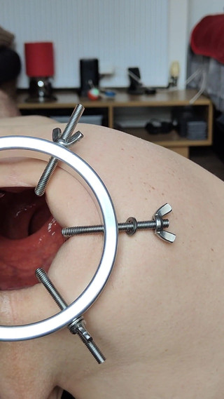 Vibrating Ball Ft David Anderson