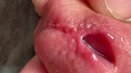 Fingers in the Penis. Hole in Penis Penetration.