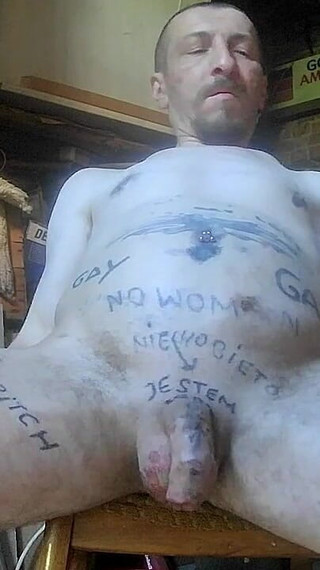 Anal Training & Rectal Prolapse 2